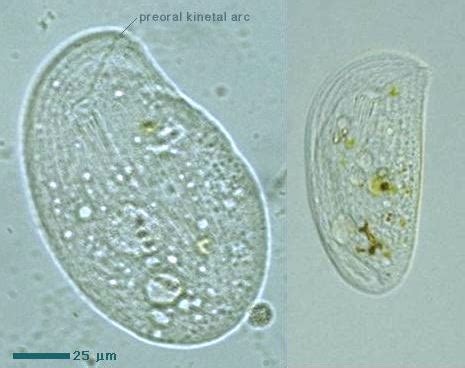  Chilodonella! A Glimpse into the World of These Tiny Ciliates