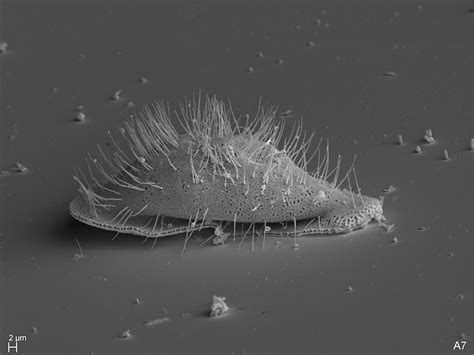  Gymnamoeba! A Masterful Amoeboid Sculptor of Microscopic Landscapes