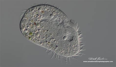  Rhizostomatium! A Ciliate With an Appetite for the Microscopic World!